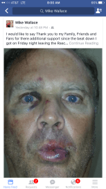 Updated photo Mike Wallace posted on his Facebook page. Mecklenburg County Sheriff's arrested three individuals and charged them with assault in relation to the incident. (Photo: Mike Wallace)